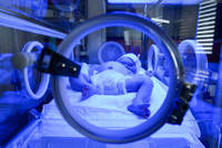 Poziom bilirubiny u noworodka - normy, interpretacja